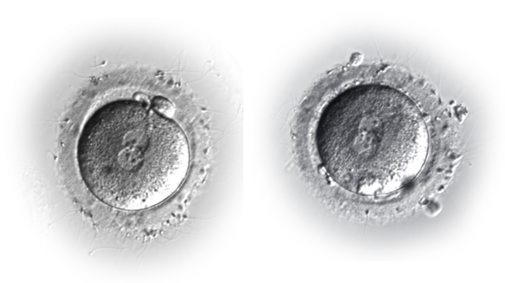 1d 1024x574 - Развитие эмбрионов